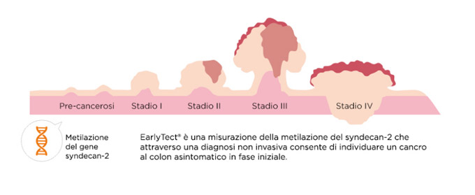 early tect test colon cancer 2